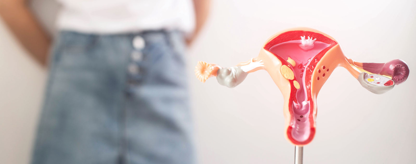 alimentos para ajudar no sindrome de ovario poliquistico