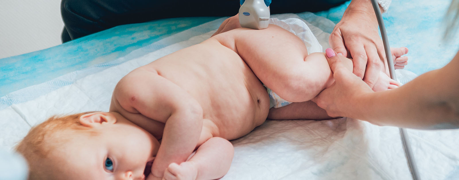 causas da displasia da anca bebé