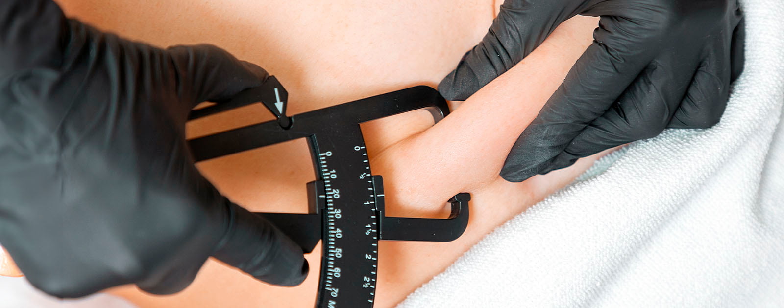 médico mede percentagem de gordura corporal de paciente