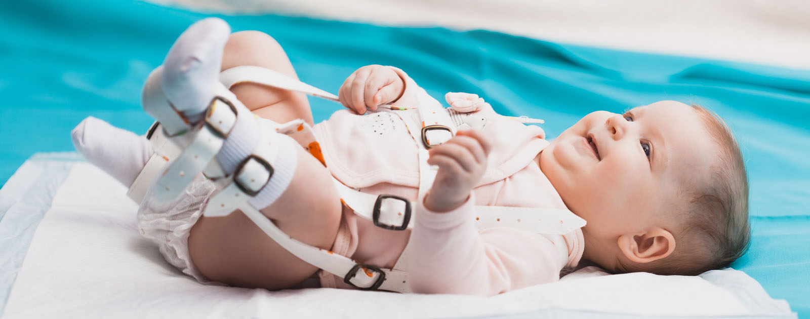 tratamento da displasia da anca bebé