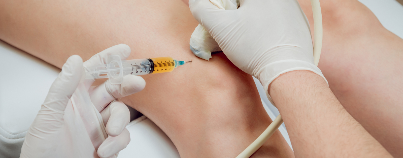 líquido no joelho tratamento