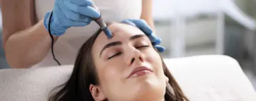 Dermatologia realiza microagulhamento em paciente