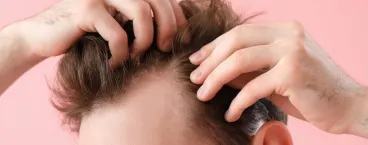 homem a verificar o seu cabelo para verificar se necessita de implantes
