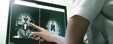 médica analisa ressonância magnética ao cérebro
