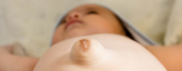 bebé com hérnia umbilical