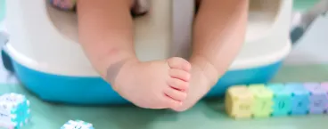 bebé com mancha mongólica no pé