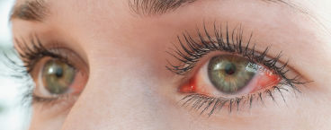 mulher com os olhos vermelhos