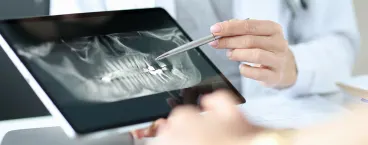 dentista mostra radiografia dentária a paciente