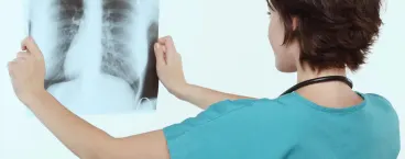 médico a examinar raio x dos pulmões