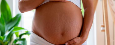 mulher grávida com estrias na barriga