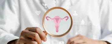 prolapso uterino