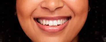 mulher com dentes muito brancos