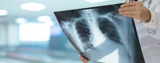 pneumonia silenciosa