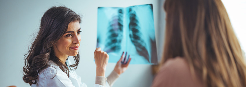médica a mostrar raio-x ao pulmão a paciente