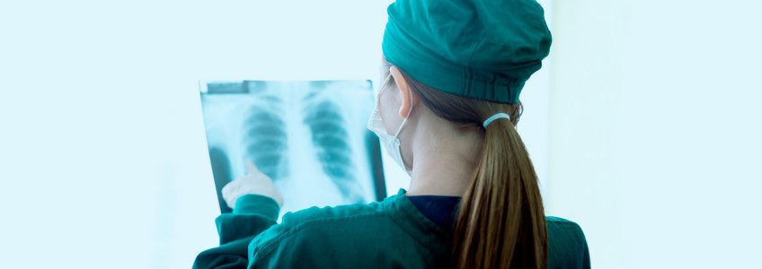 médica a analisar exame aos pulmões 