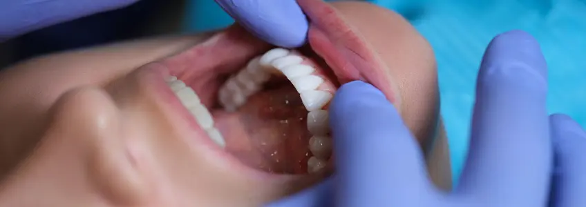 dentista observa esmalte dentário de paciente