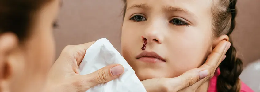 menina a sangrar do nariz