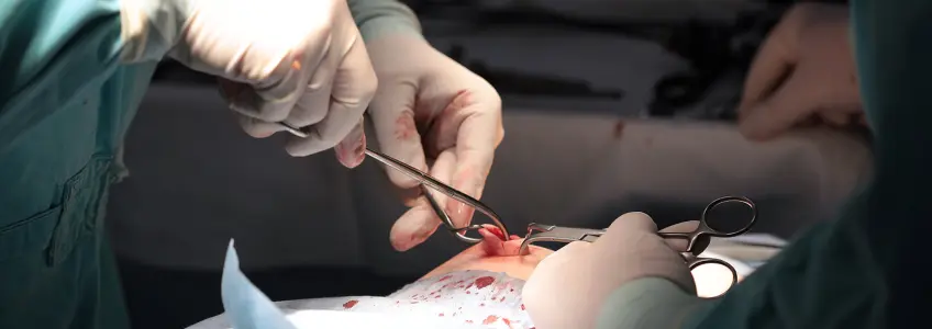 paciente a ser operado a hérnia inguinal