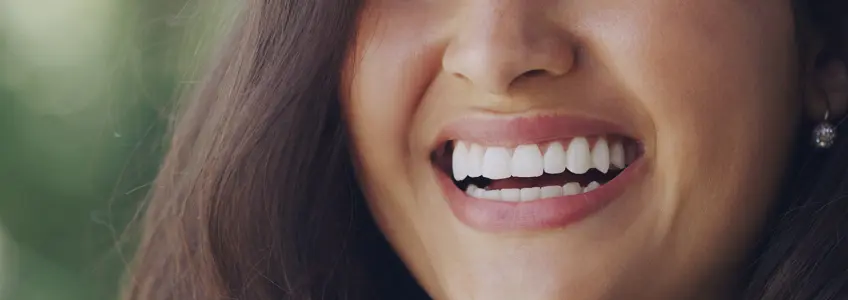 mulher com dentes muito brancos