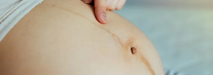 grávida com linha nigra na barriga