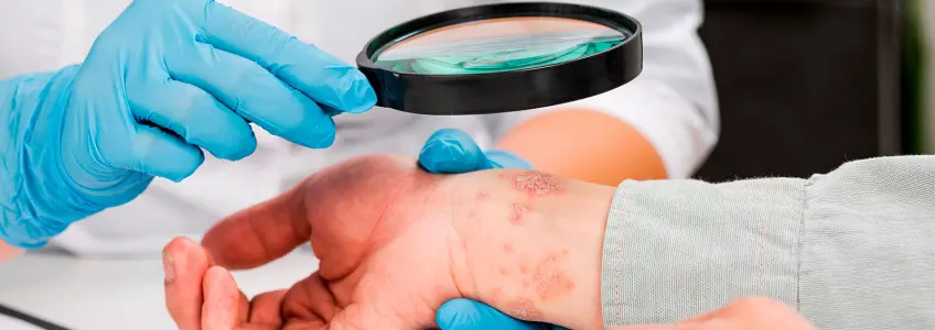 dermatologista analisa problema de pele em paciente