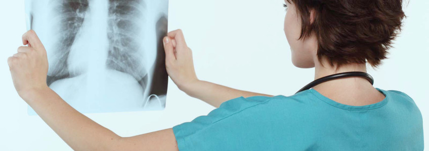 médico a examinar raio x dos pulmões