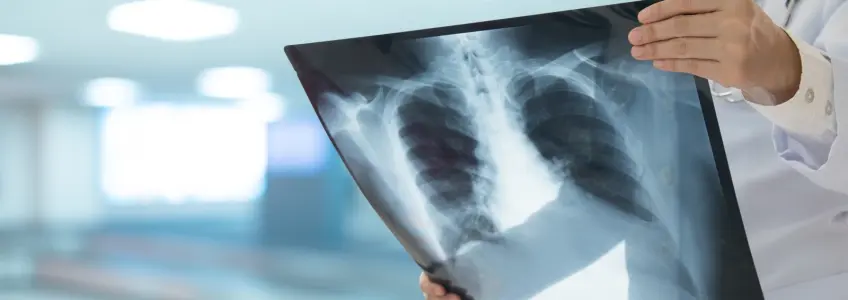 pneumonia silenciosa