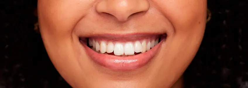 mulher com dentes muito brancos