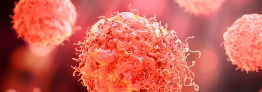 células cancerígenas