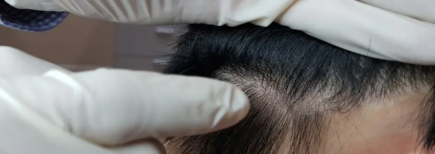 médico a analisar couro cabeludo de paciente