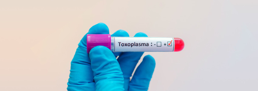 parasita toxoplasma