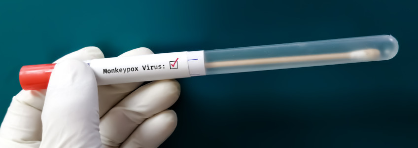 tubo de ensaio com teste Varíola-dos-macacos positivo