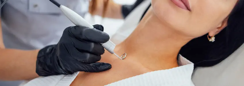 dermatologista a fazer tratamento a laser em paciente